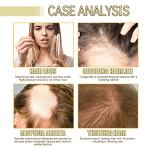 Load image into Gallery viewer, EELHOE Rosemary Dense Hair Essential Oil Repair hair damage, prevent hair loss, ooth hair, nourish hair care oil
